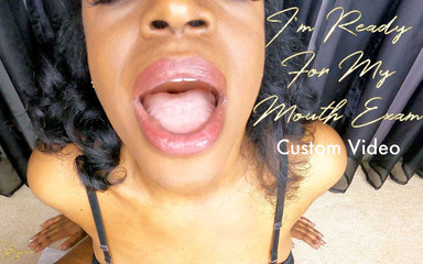 I'm ready for my mouth exam, custom