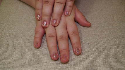 Chubby Fingers and Hands: My Palms Review