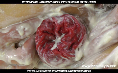 Fist Fuck Banana Split & Prolapse by Hotkinkyjo