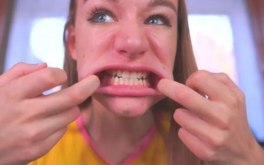 Teeth Fetish: Healthy& Crooked Caries