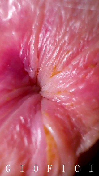 Anal Fetish: I Am Lookin at the Ceiling While My Stepfather Sniffed and Licked My Butthole